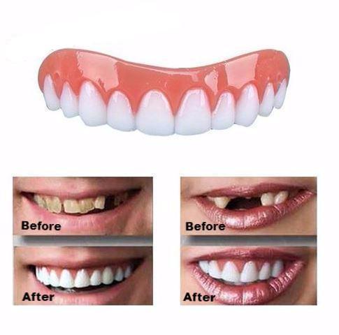 Instant Smile Comfort Veneer-Beauty-Thechoiceday.com-TheChoiceDay.com