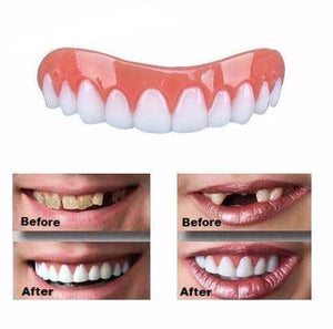 Instant Smile Comfort Veneer-Beauty-Thechoiceday.com-TheChoiceDay.com