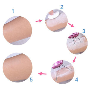 Electric Butterfly Epilator