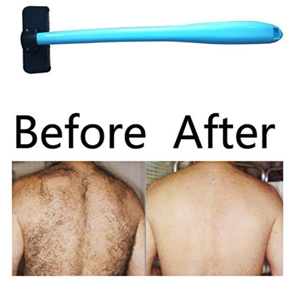 Back Hair Removal