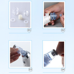 Comedo Suction Blackhead Remover